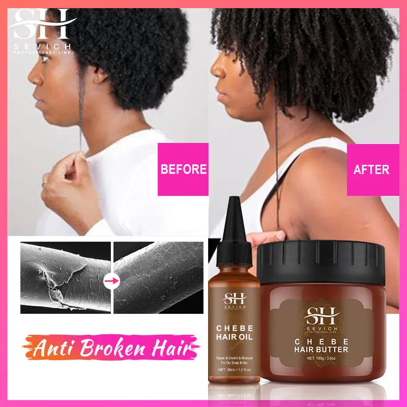 SEVICH Chebe Hair Growth Oil Set