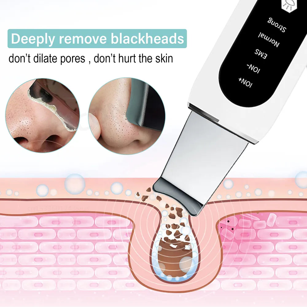 Ultrasonic Blackhead Remover & Scrubber