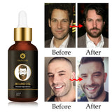 Beard Growth Essential Oil