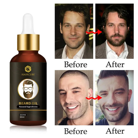 Beard Growth Essential Oil